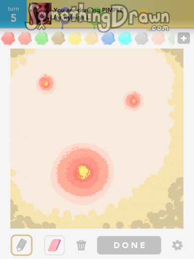 Pimple