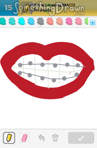 braces